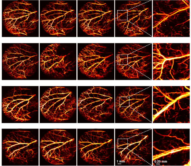 南科大生医工系本科生赵元龙在光学期刊Biomedical Optics Express发表研究成果